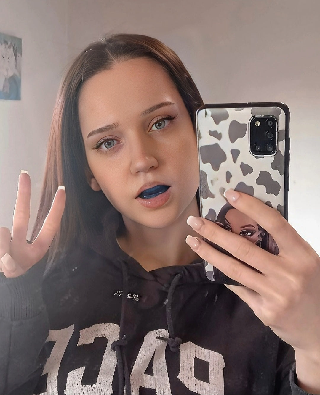 Recessed Chin Protocol