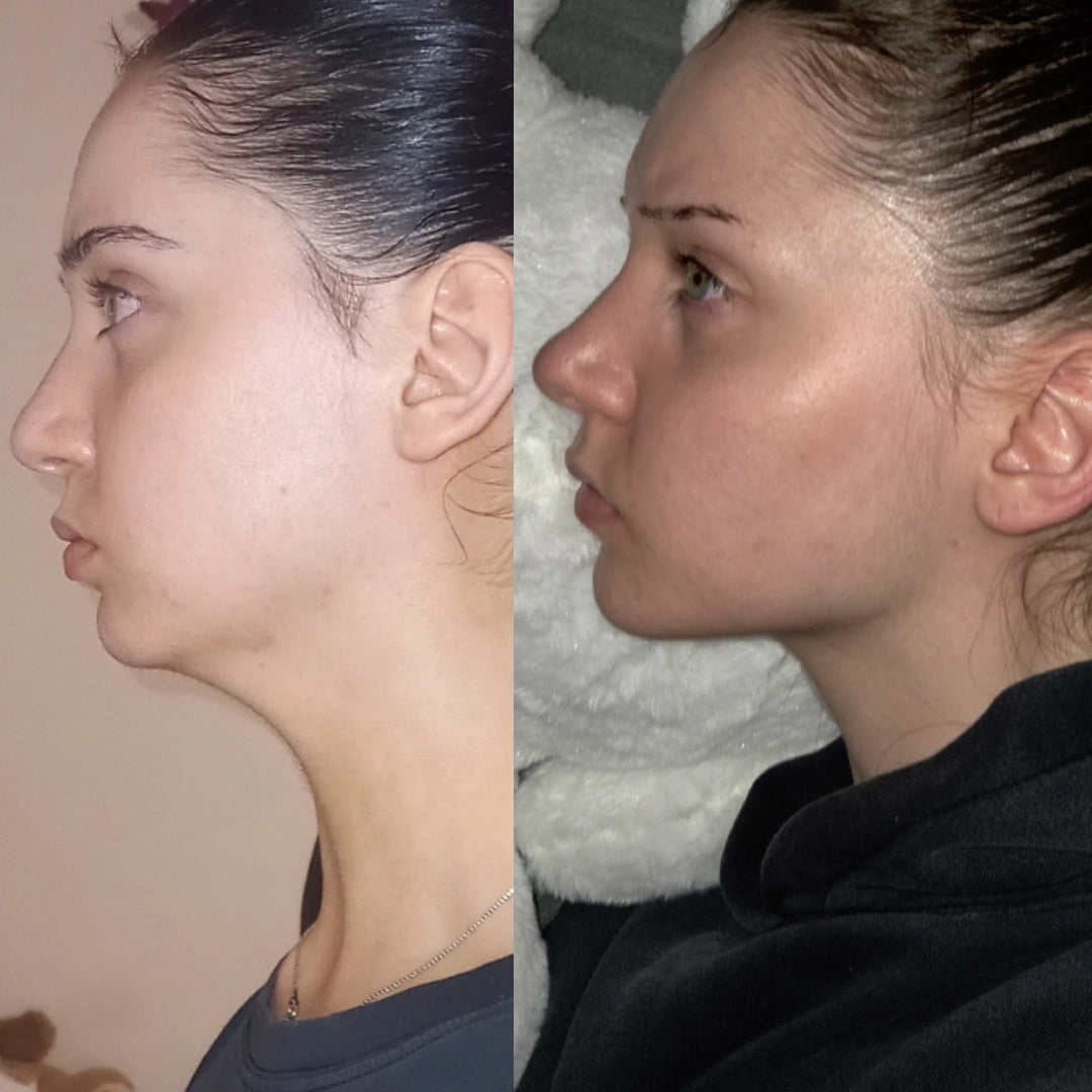 Private Community [Link in description]